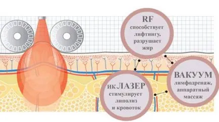Вдигане RF обратна връзка, тя е