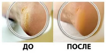 Карбамид в употреба козметика и ефект