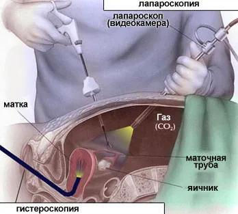 Защо няма месечна не е бременна, тестът е отрицателен