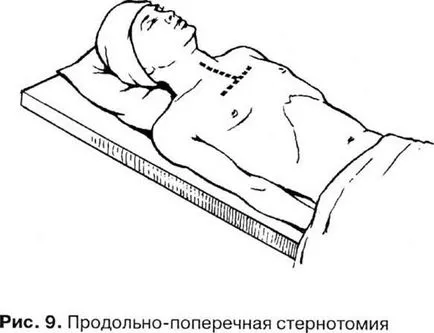 Хирургични подходи в гръдна хирургия