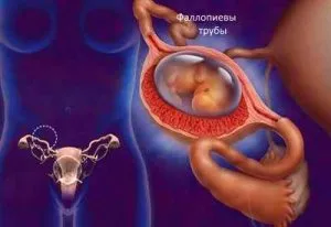 Скъсване на яйчниците, причините и симптомите, възможните последствия и усложнения