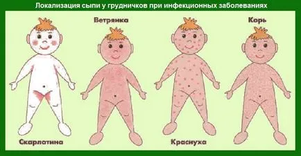 Обрив при кърмачета
