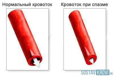 Съдово заболяване причини, видове, лечение и профилактика, васкуларната функция (причина) Съдово заболяване причини, видове, лечение и профилактика, васкуларната функция