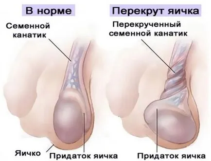 Стероидни хормони - какво е това