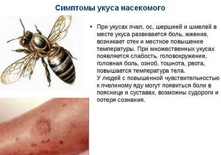 Стинг - за подуване и зачервяване на какво да правят и как да се отнасяме