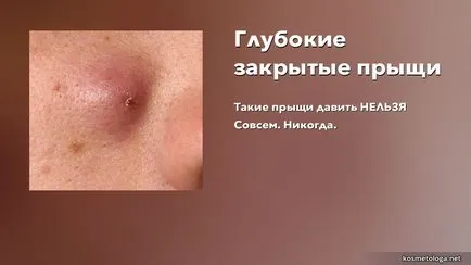 Защо не може да изтръгне пъпки