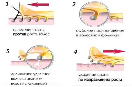 Научете защо shugaring Не дърпайте косата