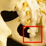 Вертеброгенни cervicalgia - Симптоми, разнообразие, лекувани с консервативни методи и фолк