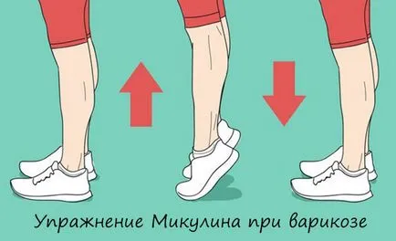Разширени вени лечение у дома