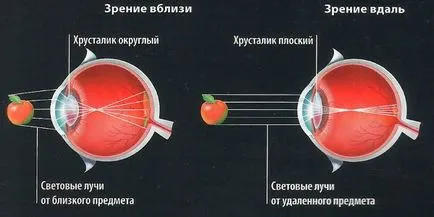 Настаняване на окото какво е лечението