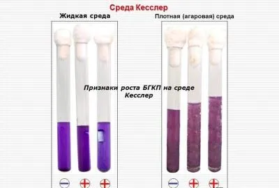 откриване Coliform в храни, месо, мляко, ГОСТ стандарти