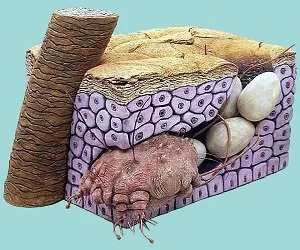 Краста снимки на човека, симптоми и лечение