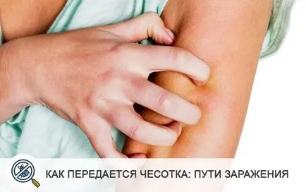 Сърбежи кърлеж снимки, симптоми, лечение (5-те най мазила) (отбележете) Сърбежи кърлеж снимки, симптоми, лечение (5-те най мазила)
