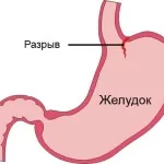 Какво става, ако има кръв в повръщане причини кървене