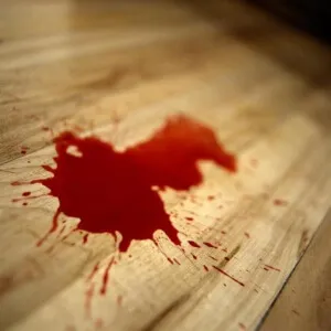 Какво става, ако има кръв в повръщане причини кървене