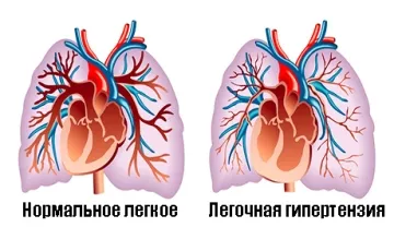 Че резултатите показват, сърцето ултразвук ехокардиография прост декодиране (сърдечен ултразвук новородено препис) представят сърдечна ултразвук ехокардиографски прости резултати, декодиране