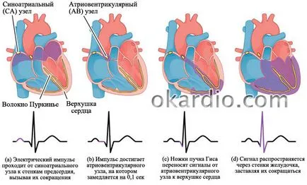 Предсърдно мъждене симптоми, лечение, и прогноза форма