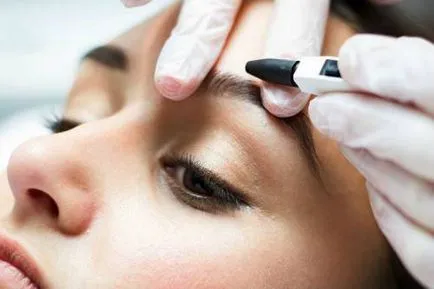 Електролиза на текущата лицето (elekticheskaya), мнения за нея