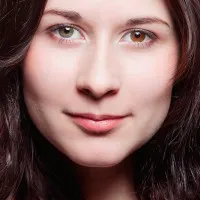 Очи с различен цвят (хетерохромия), това означава, че raznoglaziya на причините (снимка) (причина) Очи с различен цвят (хетерохромия), това означава, че raznoglaziya на причините (снимка)