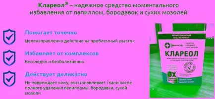 Как да се отървете от брадавици дом и медицински методи