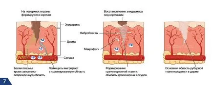 Как да се отървем от белези - крем и крем за белези по лицето