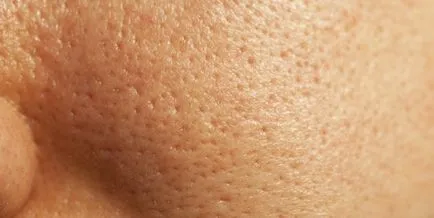 Как да се стесни порите на лицето, рецепти, методи, видео