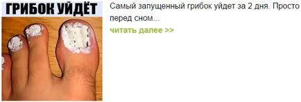 Кандидозата на хранопровода причини, симптоми, лечение, снимка (езофагеална кандидоза) Кандидозата на хранопровода причини, симптоми, лечение, снимки