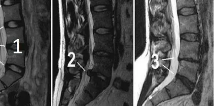 CT и MRI е разликата, каква разлика, която е по-добре