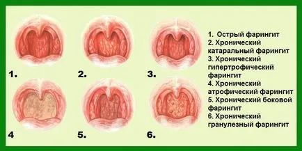 Червена гърлото при кърмачета