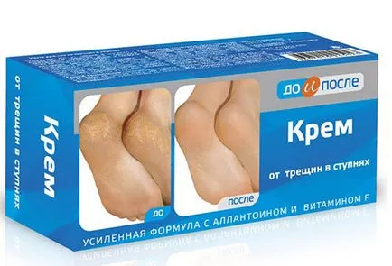Крем за крака - как да изберем
