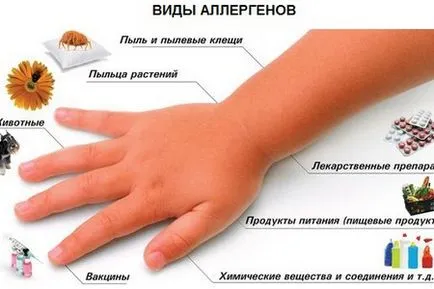 Малки пъпки по лицето на новородено бяло, червено