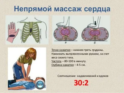 Гръдна компресия - машини производителност, особено