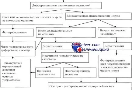 диспластични невуси