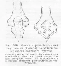 Рамо Ръководство на лекар