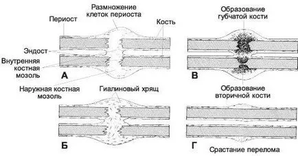 Защо не направите това фрактурите лекува