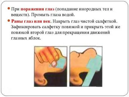 Повреда на роговицата на окото, лечение, последствията, ексфолиране, реставрация