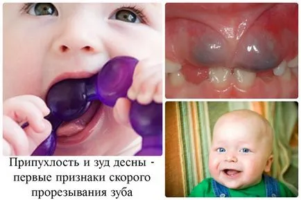 Както зъбите започва да се катери
