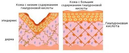 Списък на кремове за лице с хиалуронова киселина