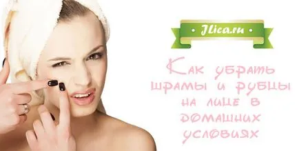 Премахване на белези по лицето на най-добрите начини и мнения (премахване премахнат съединителната белези кожата на лицето пътищата на мнения) Премахване на белези по лицето на най-добрите начини и мнения