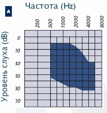 Възстановяване на слуха във всички форми на загуба на слуха (форми) Възстановяване на слуха във всички форми на загуба на слуха