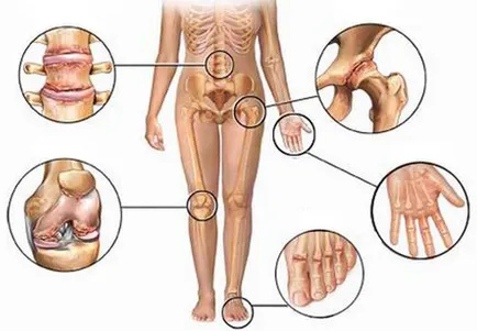 Инжекциите alflutop какво