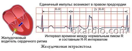 Bigemini какво е