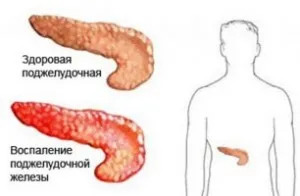 Като болка в стомаха след хранене