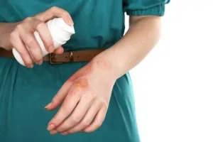 Как да се отървем от блистерите