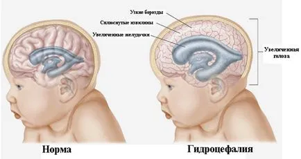 Какво трябва да направя, ако главата е голяма