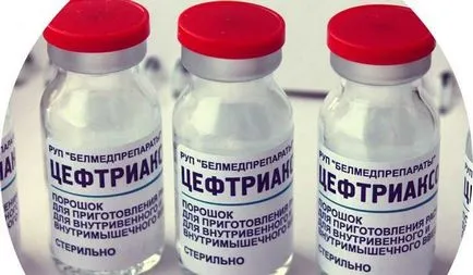 Как бързо да се отървете от възпалено гърло