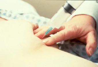 лечение Fibroadenomatosis гърдата