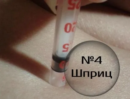 Как да се извлече от кърлежи