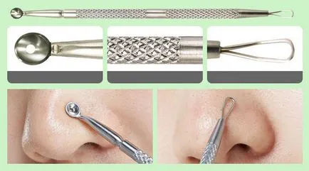 Какво е комедони по лицето