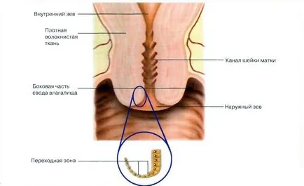 лечение ендоцервикалните кисти лечение ендоцервикалните кисти